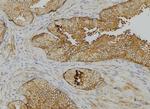 Phospho-Cytokeratin 17 (Tyr98) Antibody in Immunohistochemistry (Paraffin) (IHC (P))