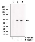 Phospho-Cytokeratin 17 (Tyr98) Antibody in Western Blot (WB)