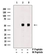 Phospho-CTDSPL2 (Ser9) Polyclonal Antibody
