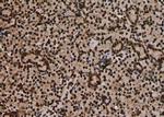 Phospho-Btk (Tyr223, Tyr225) Polyclonal Antibody