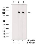 Phospho-DDR1 (Tyr520) Antibody in Western Blot (WB)