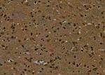 Phospho-NMDAR2A (Tyr943) Antibody in Immunohistochemistry (Paraffin) (IHC (P))