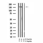 Phospho-NMDAR2A (Tyr943) Antibody in Western Blot (WB)