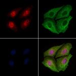 Phospho-TDP-43 (Ser409) Polyclonal Antibody