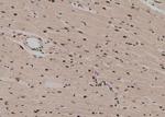 Phospho-MST2 (Ser316) Antibody in Immunohistochemistry (Paraffin) (IHC (P))