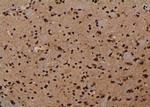 Phospho-NMDAR2B (Ser1303) Polyclonal Antibody