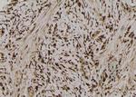 Phospho-SQSTM1 (Ser366) Polyclonal Antibody