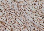 Phospho-SQSTM1 (Ser366) Antibody in Immunohistochemistry (Paraffin) (IHC (P))