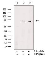 Phospho-SQSTM1 (Ser266) Antibody in Western Blot (WB)