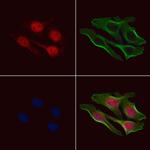 Phospho-4EBP1 (Thr45) Polyclonal Antibody