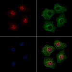 Phospho-Beclin 1 (Ser279) Polyclonal Antibody