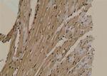 Phospho-Beclin 1 (Ser279) Antibody in Immunohistochemistry (Paraffin) (IHC (P))