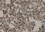 Phospho-Beclin 1 (Ser279) Antibody in Immunohistochemistry (Paraffin) (IHC (P))