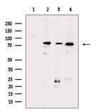 Phospho-MEF2D (Ser180) Antibody in Western Blot (WB)