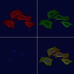 Phospho-PSD93 (Tyr348) Polyclonal Antibody