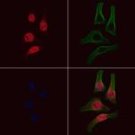 Phospho-EZH2 (Thr487) Polyclonal Antibody