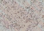 Phospho-Zyxin (Tyr316) Polyclonal Antibody