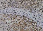 Phospho-Zyxin (Tyr316) Antibody in Immunohistochemistry (Paraffin) (IHC (P))