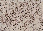 Phospho-PKN2 (Ser815) Polyclonal Antibody