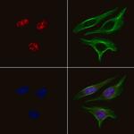 Phospho-ERK3 (Ser189) Polyclonal Antibody