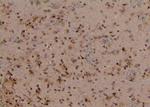 Phospho-TBC1D1 (Ser627) Antibody in Immunohistochemistry (Paraffin) (IHC (P))