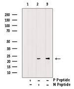 Phospho-FADD (Ser41) Antibody in Western Blot (WB)