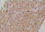 Phospho-ATG14 (Thr429) Polyclonal Antibody