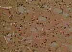 Phospho-ATG14 (Thr429) Antibody in Immunohistochemistry (Paraffin) (IHC (P))
