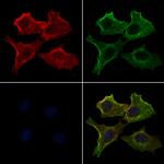 Phospho-MOB4A (Tyr26) Polyclonal Antibody
