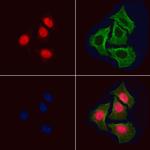 Phospho-BCL9L (Ser21 ) Polyclonal Antibody