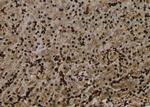 Phospho-BCL9L (Ser21 ) Antibody in Immunohistochemistry (Paraffin) (IHC (P))