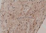 Phospho-BCL9L (Ser21 ) Antibody in Immunohistochemistry (Paraffin) (IHC (P))