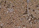 Phospho-VPS34 (Ser244, Ser249) Polyclonal Antibody
