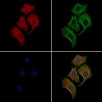 Phospho-MAPK15 (Tyr177) Polyclonal Antibody