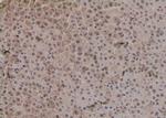 Phospho-SGK3 (Ser486) Polyclonal Antibody