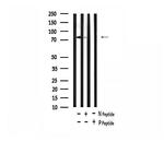 Phospho-REPS1 (Ser272) Antibody in Western Blot (WB)