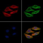 Phospho-DNAJC2 (Ser49) Polyclonal Antibody