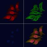 Phospho-LIN28A (Ser200) Polyclonal Antibody