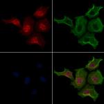 Phospho-LATS2 (Ser872) Polyclonal Antibody