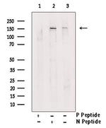 Phospho-LATS2 (Ser872) Antibody in Western Blot (WB)