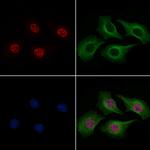Phospho-SOX2 (Ser249, Ser250) Antibody in Immunocytochemistry (ICC/IF)