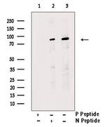 Phospho-Nephrin (Tyr1176) Polyclonal Antibody