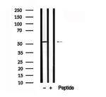 NEK2 Antibody in Western Blot (WB)