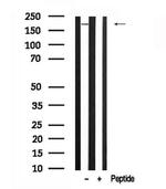 FANCA Antibody in Western Blot (WB)