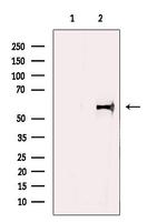 GABRB1 Polyclonal Antibody