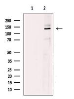 TBC1D1 Antibody in Western Blot (WB)
