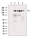 TBC1D1 Polyclonal Antibody