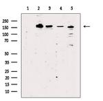 BCL9L Antibody in Western Blot (WB)