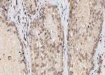 BAP1 Polyclonal Antibody