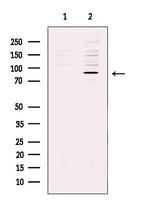 REPS1 Polyclonal Antibody